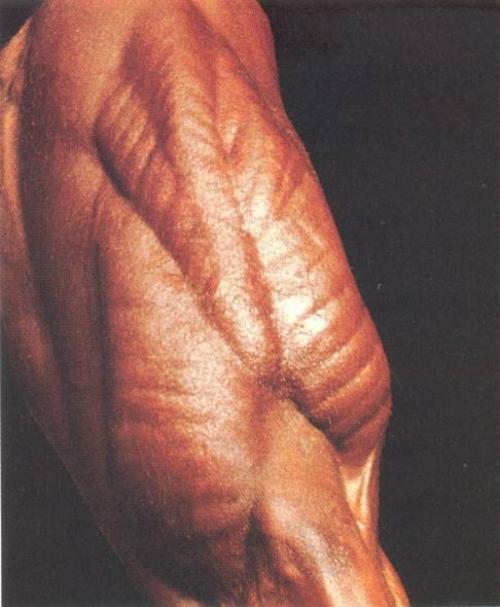 Знаменитые спортсмены, умершие на пике карьеры