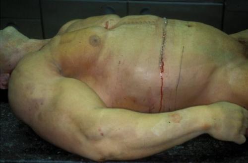 Знаменитые спортсмены, умершие на пике карьеры