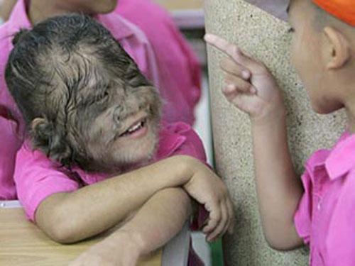 Девочка-обезьянка живет в Таиланде