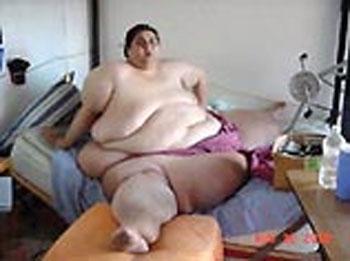 Мексиканского толстяка будут резать