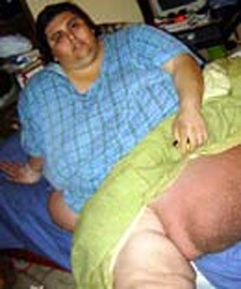 Мексиканского толстяка будут резать