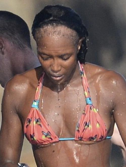 Плешивые знаменитости, которые безуспешно пытаются скрыть лысину