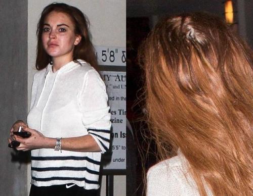 Плешивые знаменитости, которые безуспешно пытаются скрыть лысину