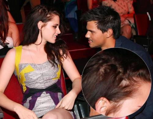 Плешивые знаменитости, которые безуспешно пытаются скрыть лысину