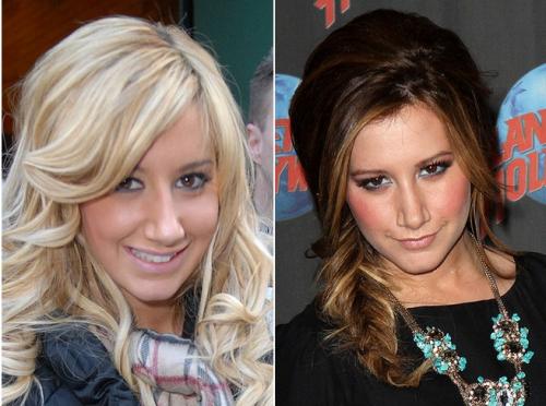 Переделанные носы знаменитостей: до и после