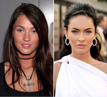 Переделанные носы знаменитостей: до и после