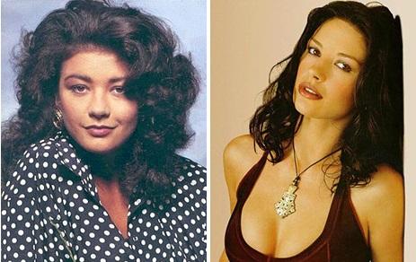 Переделанные носы знаменитостей: до и после