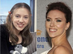 Переделанные носы знаменитостей: до и после