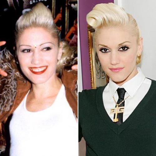 Переделанные носы знаменитостей: до и после