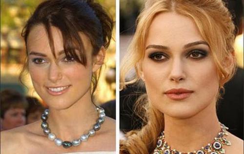 Переделанные носы знаменитостей: до и после