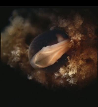 Зарождение жизни: уникальные съемки из материнской утробы