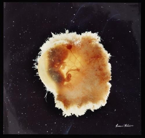 Зарождение жизни: уникальные съемки из материнской утробы