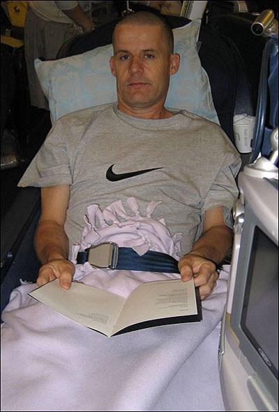 Мужчина выжил после страшного удара молнии в голову