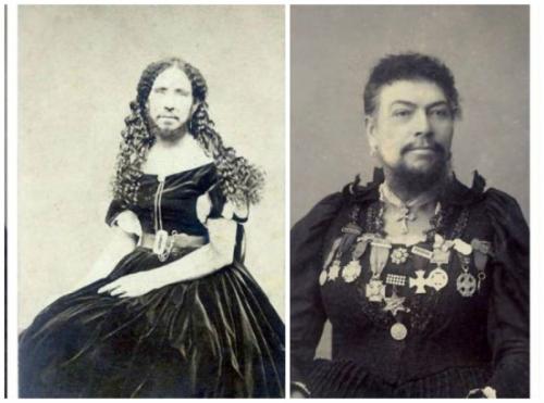 Самые известные бородатые женщины в истории
