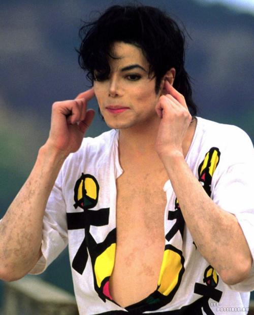 Звезды, ставшие неузнаваемыми после пластических операций