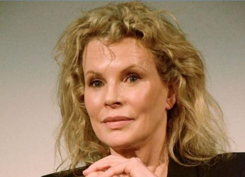 Звезды, ставшие неузнаваемыми после пластических операций