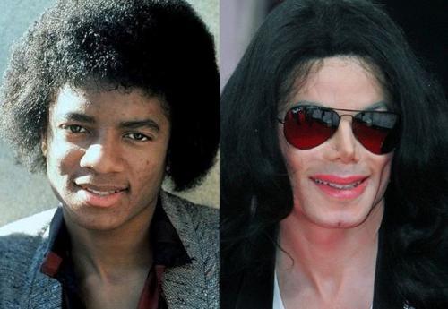 Звезды, ставшие неузнаваемыми после пластических операций