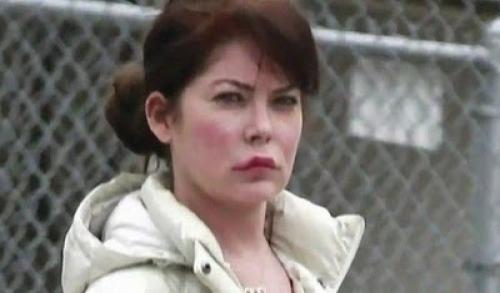 Звезды, ставшие неузнаваемыми после пластических операций