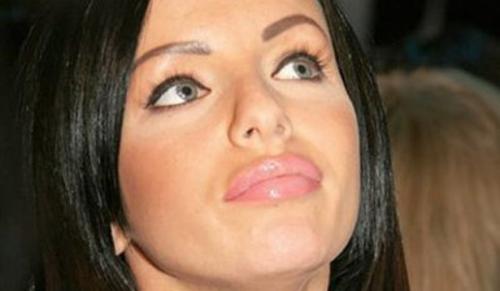 Звезды, ставшие неузнаваемыми после пластических операций