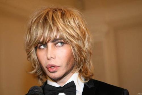 Звезды, ставшие неузнаваемыми после пластических операций