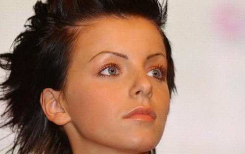 Звезды, ставшие неузнаваемыми после пластических операций