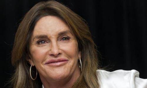 Звезды, ставшие неузнаваемыми после пластических операций