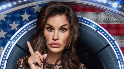 Звезды, ставшие неузнаваемыми после пластических операций