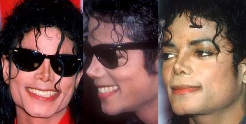 Звезды, ставшие неузнаваемыми после пластических операций