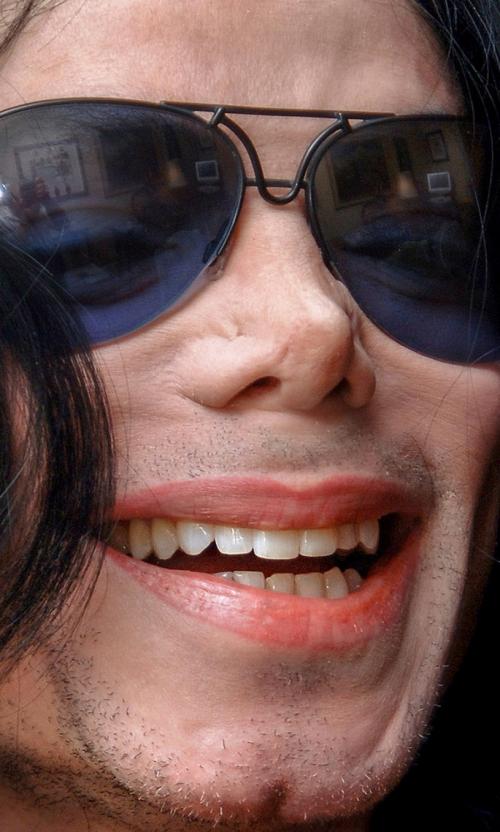 Звезды, ставшие неузнаваемыми после пластических операций