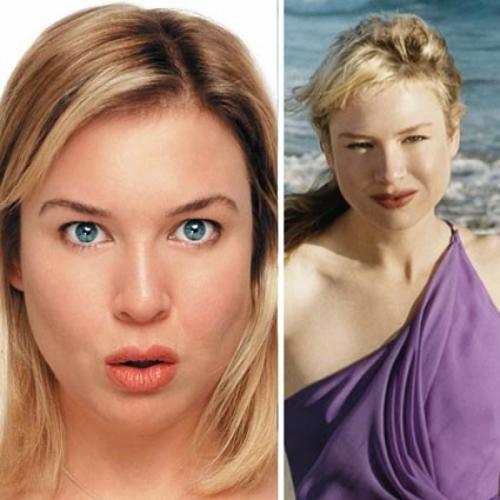 Звезды, ставшие неузнаваемыми после пластических операций