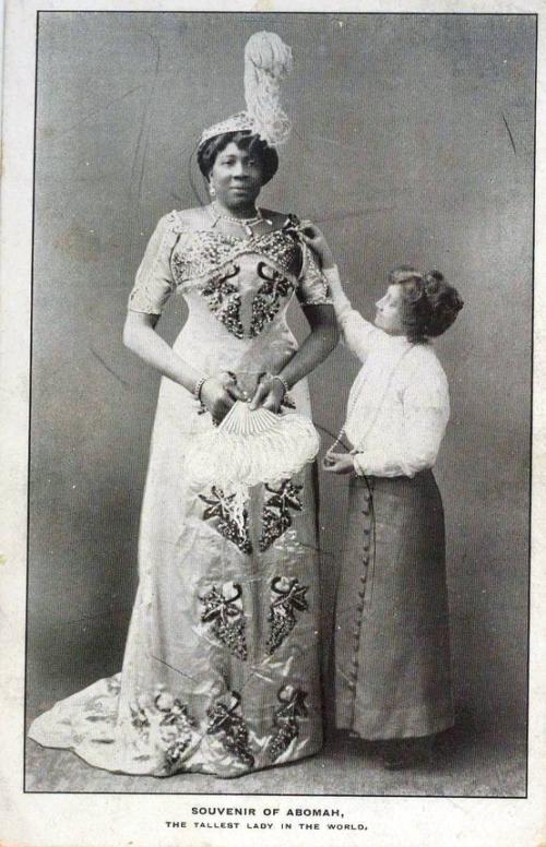 Люди в клетке: самые знаменитые персонажи цирка уродцев