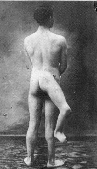 Люди в клетке: самые знаменитые персонажи цирка уродцев