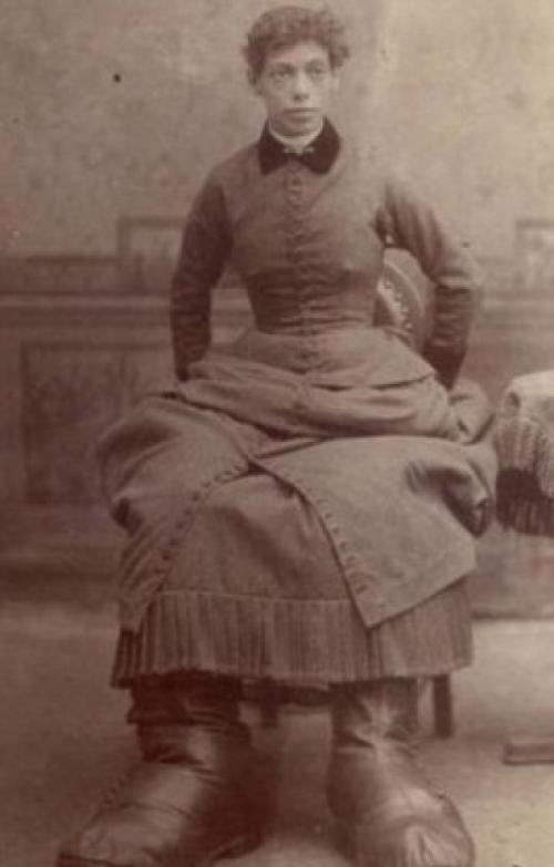 Люди в клетке: самые знаменитые персонажи цирка уродцев