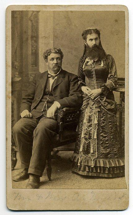 Люди в клетке: самые знаменитые персонажи цирка уродцев