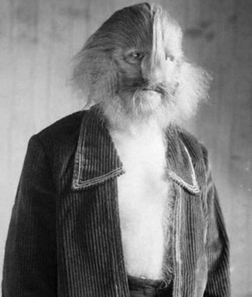 Люди в клетке: самые знаменитые персонажи цирка уродцев