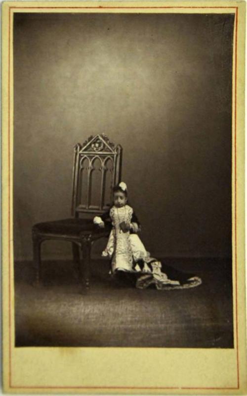 Люди в клетке: самые знаменитые персонажи цирка уродцев