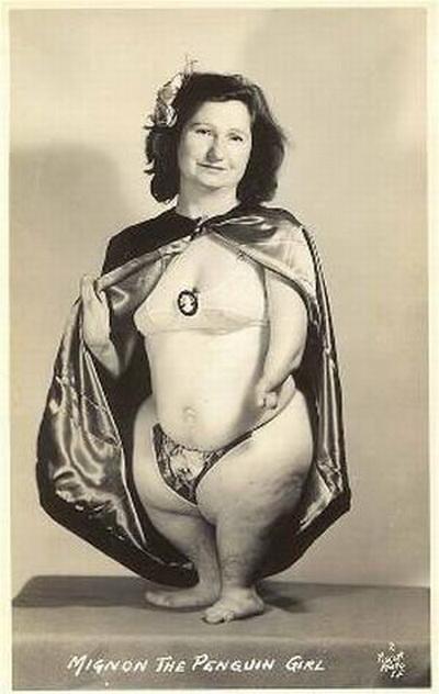 Люди в клетке: самые знаменитые персонажи цирка уродцев