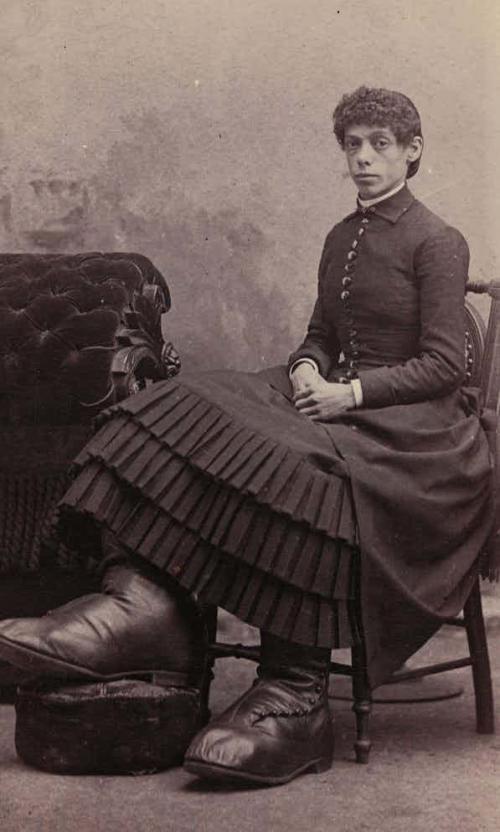 Люди в клетке: самые знаменитые персонажи цирка уродцев