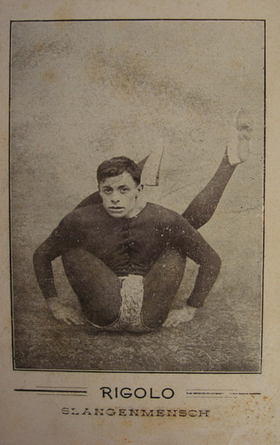 Люди в клетке: самые знаменитые персонажи цирка уродцев