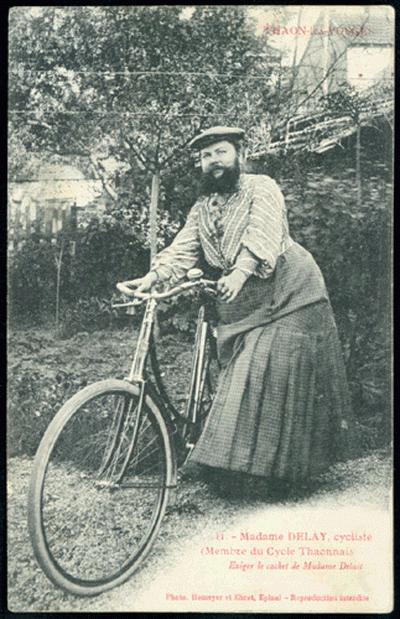 Люди в клетке: самые знаменитые персонажи цирка уродцев