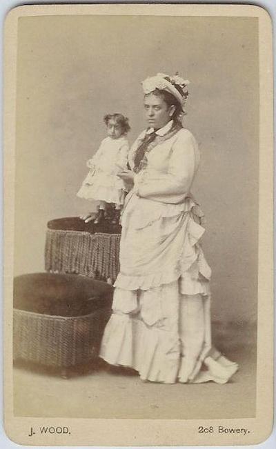 Люди в клетке: самые знаменитые персонажи цирка уродцев