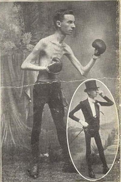 Люди в клетке: самые знаменитые персонажи цирка уродцев