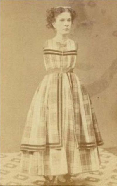 Люди в клетке: самые знаменитые персонажи цирка уродцев