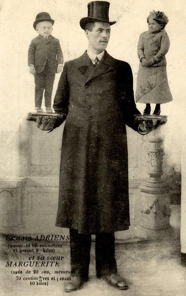 Люди в клетке: самые знаменитые персонажи цирка уродцев