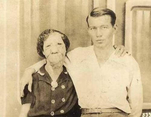 Люди в клетке: самые знаменитые персонажи цирка уродцев