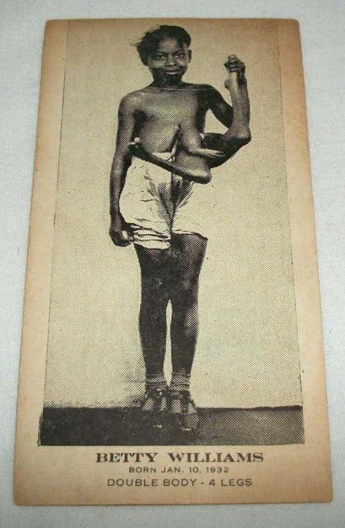 Люди в клетке: самые знаменитые персонажи цирка уродцев