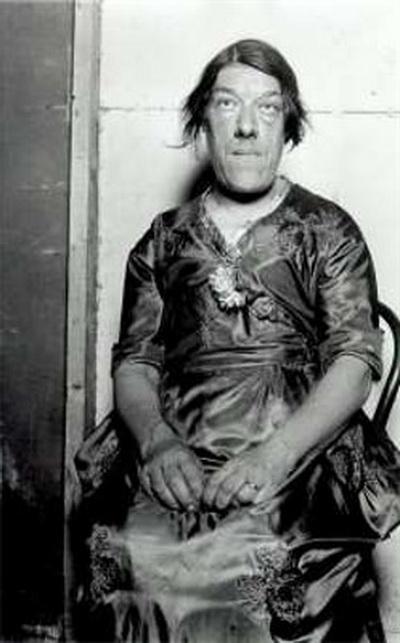 Люди в клетке: самые знаменитые персонажи цирка уродцев