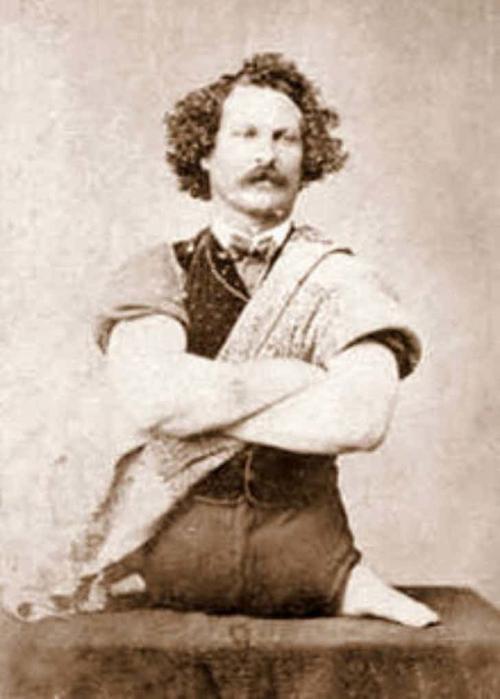 Люди в клетке: самые знаменитые персонажи цирка уродцев