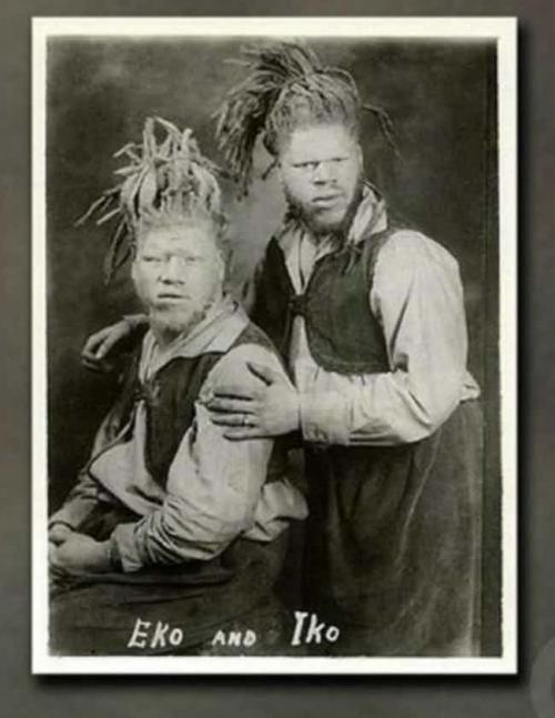 Люди в клетке: самые знаменитые персонажи цирка уродцев