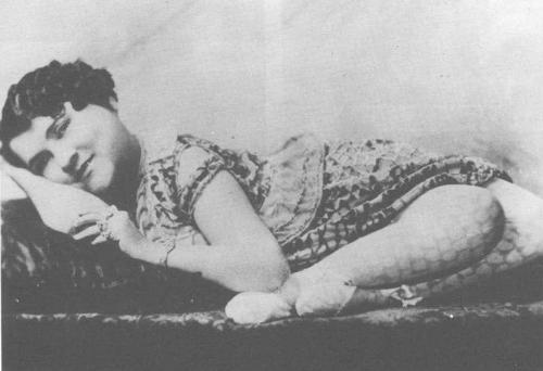 Люди в клетке: самые знаменитые персонажи цирка уродцев